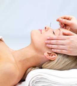 San Francisco Acupuncture Care
