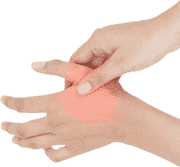 What is Peripheral Neuropathy?
